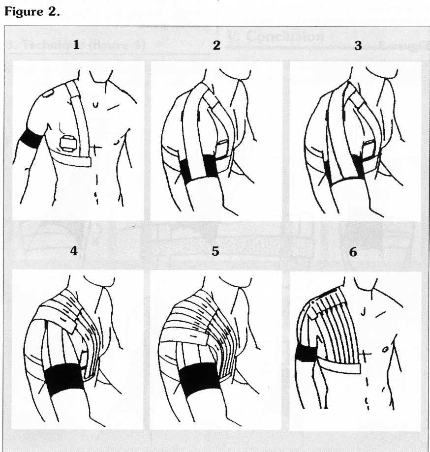 strappourepaule handballenpaysdelasoie